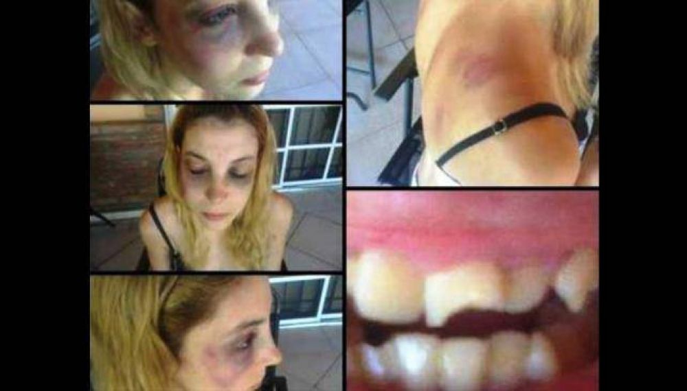 Su pareja la golpe� y ella lo mostr� a trav�s de Internet