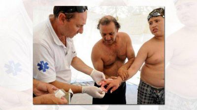 Palometas en Rosario: a siete chicos tuvieron que amputarles dedos