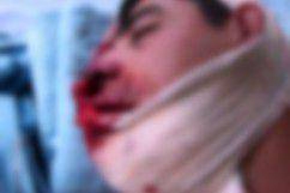 Un hombre se encuentra en grav�simo estado tras intentar suicidarse de un disparo en la cabeza