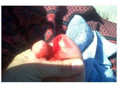 Denuncian mordeduras de palometas en el parque San Mart�n