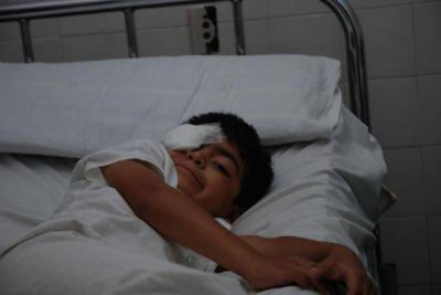 Al menos unos 15 ni�os lesionados con pirotecnia, ninguno de gravedad