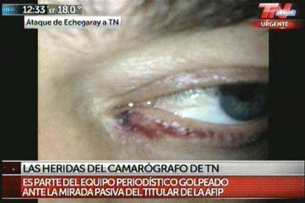 As� qued� el camar�grafo de TN agredido por amigos de Ricardo Echegaray