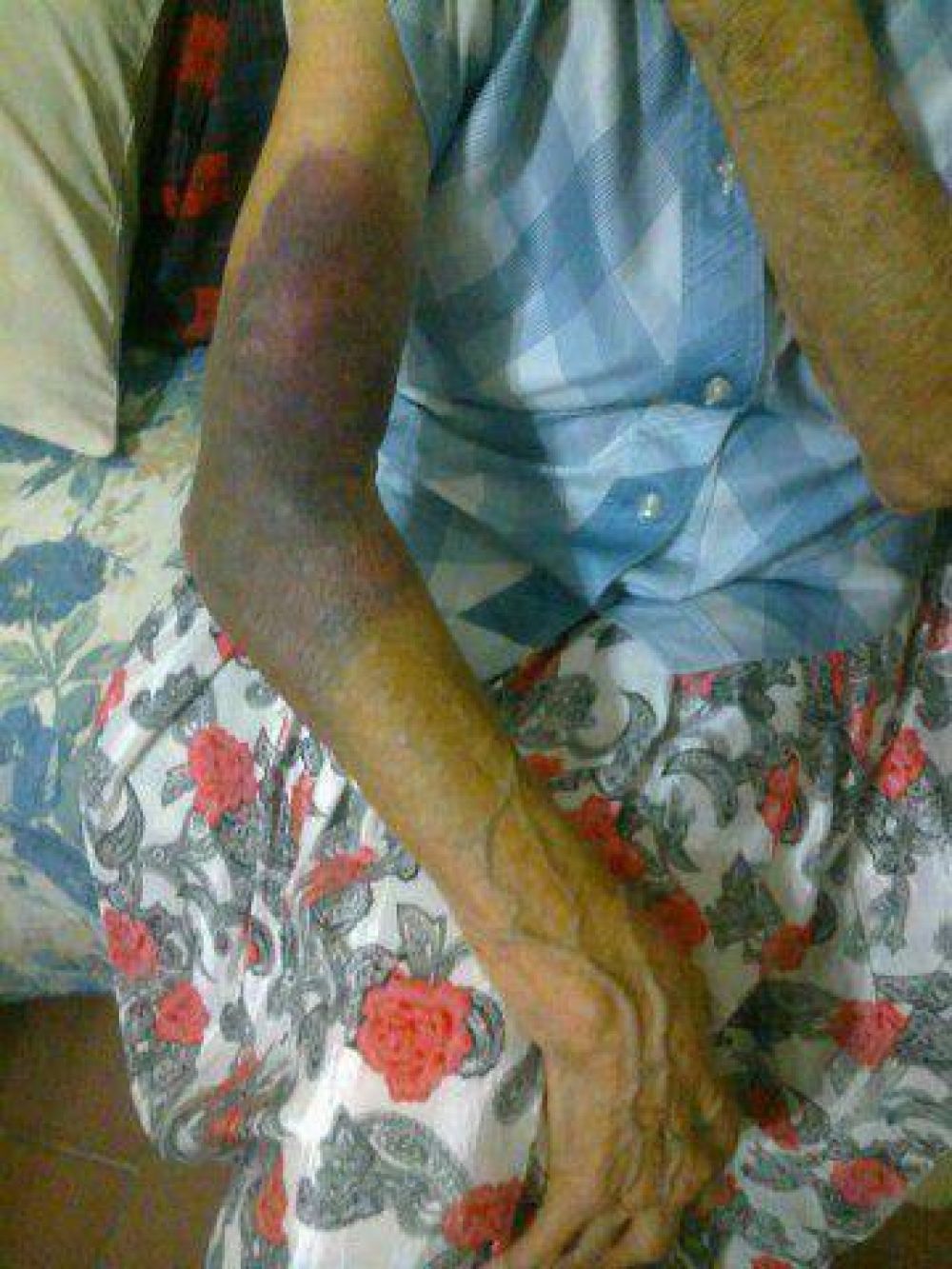 Una anciana y su hijo discapacitado fueron robados y golpeados tres veces en diez d�as