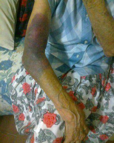 Una anciana y su hijo discapacitado fueron robados y golpeados tres veces en diez d�as