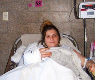 Le reimplantaron una mano amputada a una embarazada