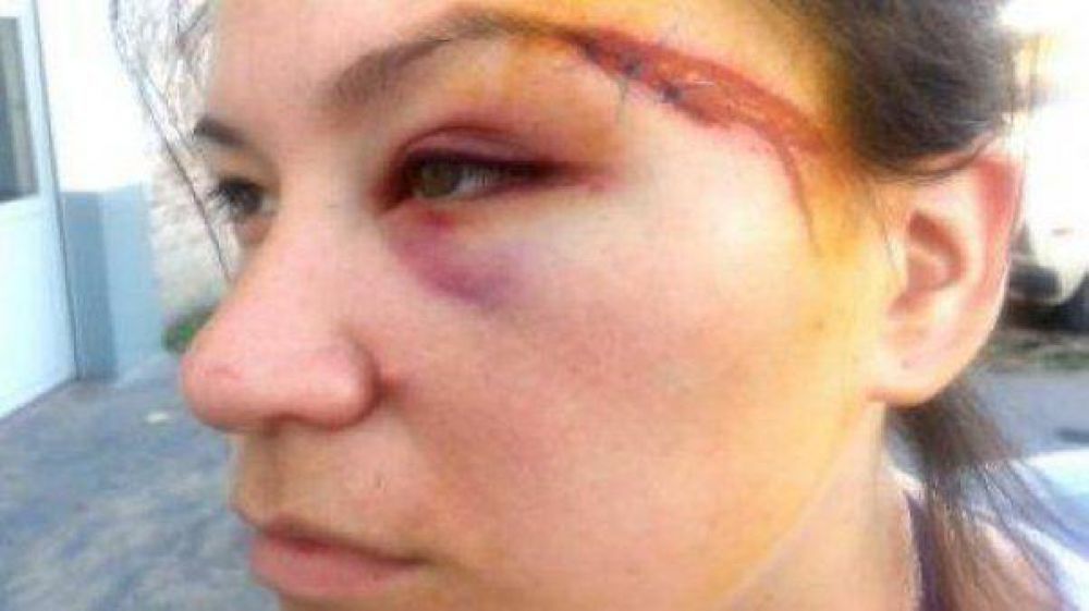 Brutal golpiza de un profesor de boxeo a su ex y a su cu�ada