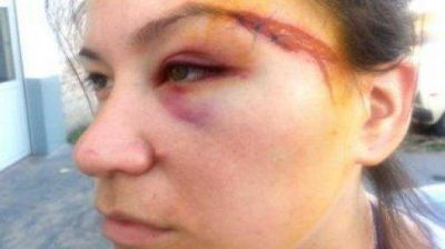 Brutal golpiza de un profesor de boxeo a su ex y a su cu�ada