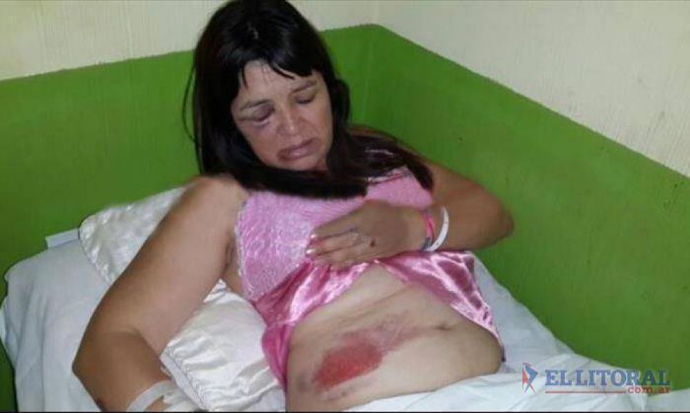 Motochorros tiraron a mujer de una moto para robarle la cartera