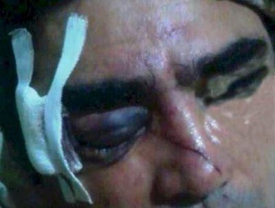 Esquina: un hombre denunci� terrible golpiza en un boliche