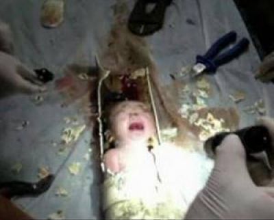 En China, una pol�mica forma de cuidar bebes abandonados