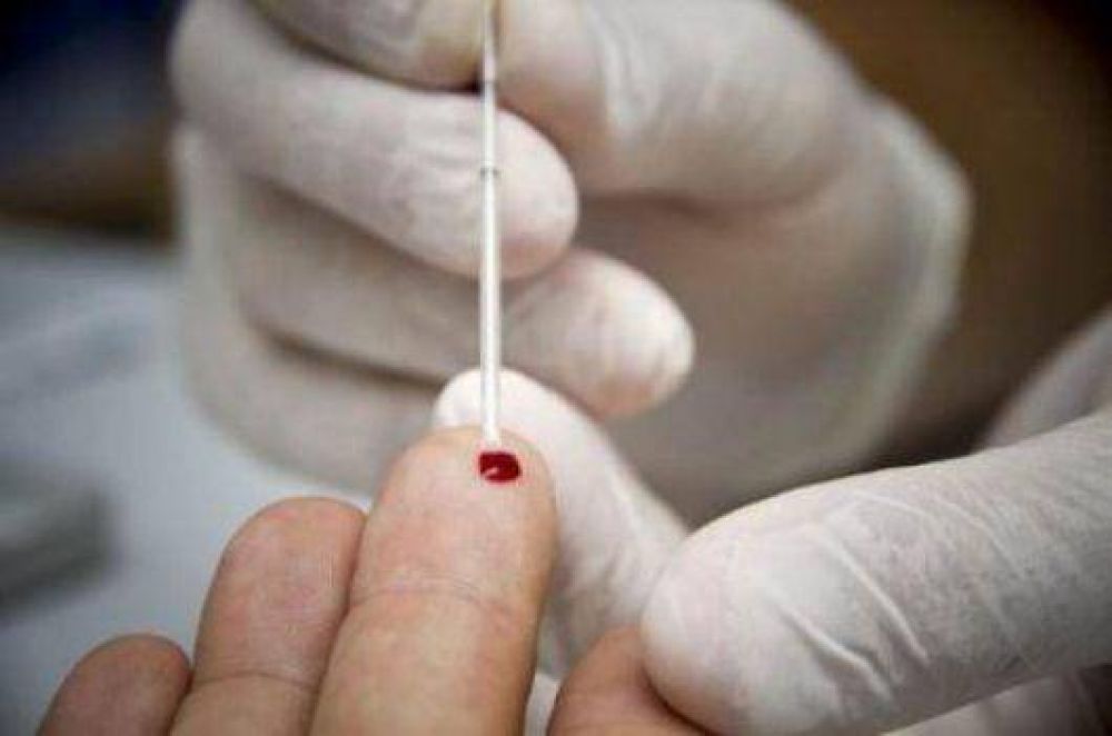 Test de VIH: ser�an obligatorios para pacientes que ingresan en hospitales