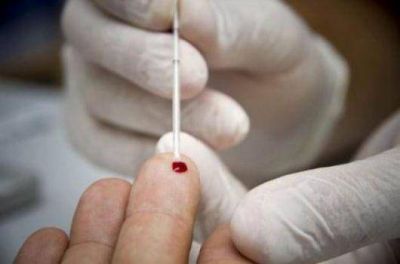 Test de VIH: ser�an obligatorios para pacientes que ingresan en hospitales