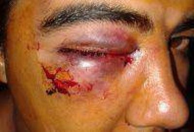 Denuncia que fue golpeado por m�s de siete patovicas