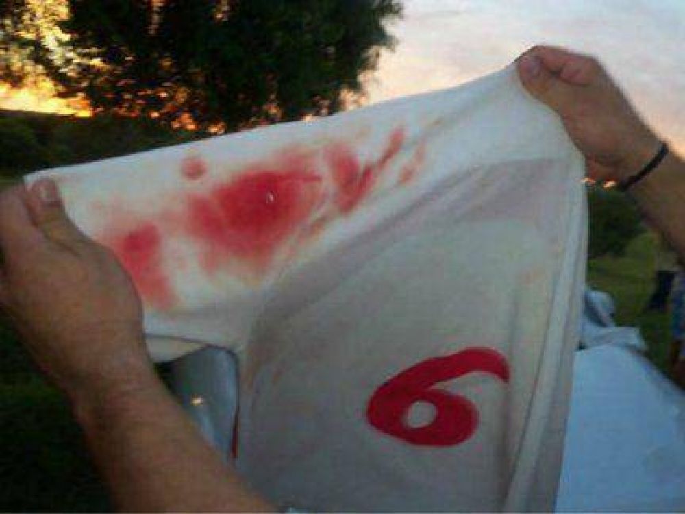 Un chico de 12 a�os result� baleado a la salida de un partido en Feliciano 