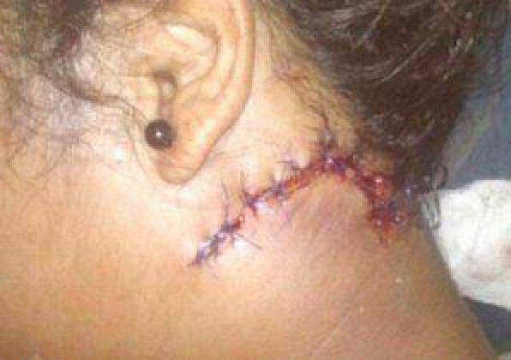 Prisi�n preventiva a quien cort� el cuello a adolescente