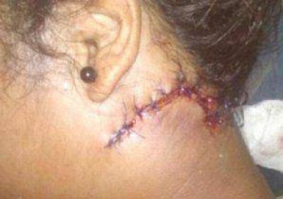 Prisi�n preventiva a quien cort� el cuello a adolescente