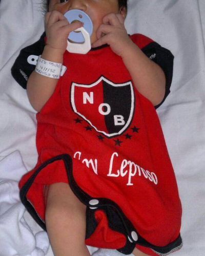 Leproso desde la cuna: un beb� llamado Newells