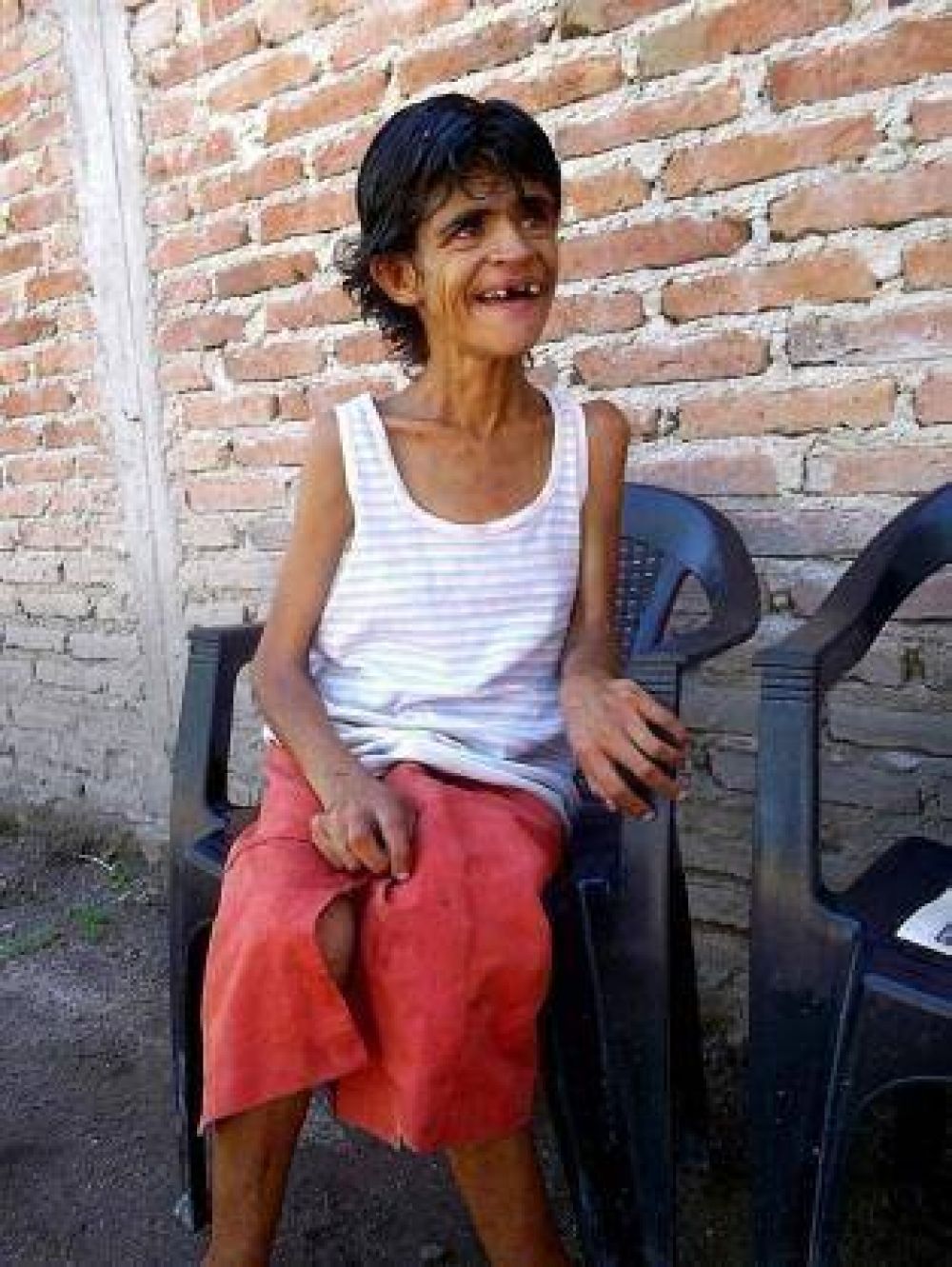 El drama de Blanquita, la mujer que de tan fr�gil apenas puede caminar