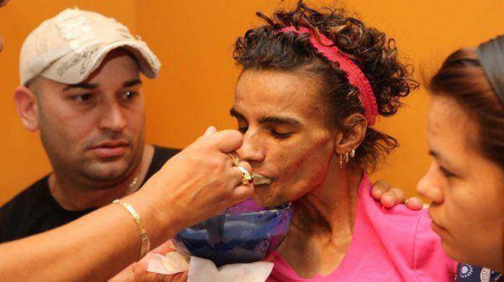 Una mujer qued� parapl�jica despu�s de hacerse un implante de senos