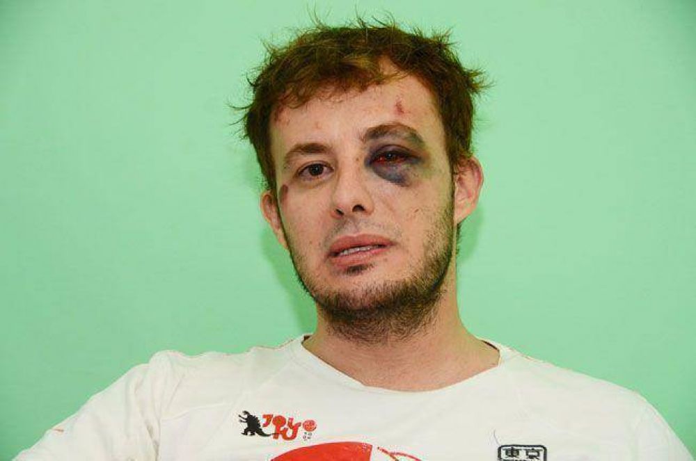 Salvaje golpiza policial a un joven por un incidente dentro de Kryon