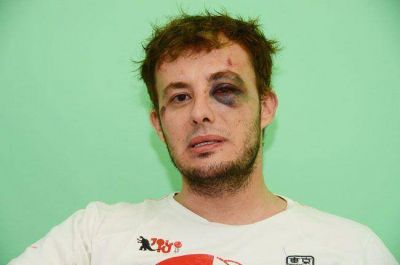 Salvaje golpiza policial a un joven por un incidente dentro de Kryon