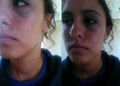 Acusan a un polic�a y su familia por una golpiza