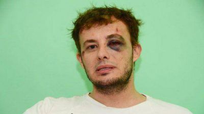 Brutal golpiza a un joven por ser gay en La Pampa