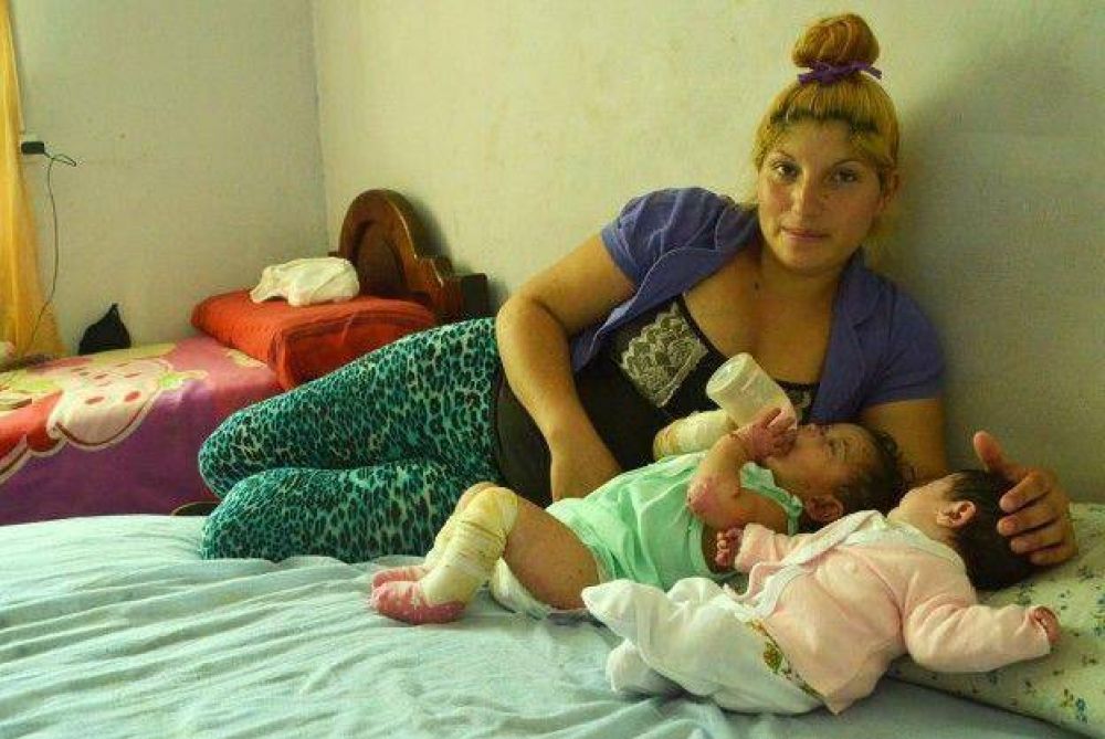 Tiene dos hijas con piel de cristal y pide ayuda