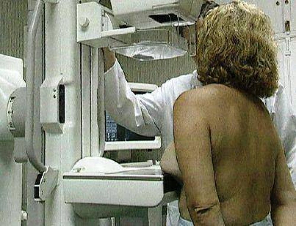 C�ncer en La Pampa: prevalecen el de mama, colon, �tero y pulm�n