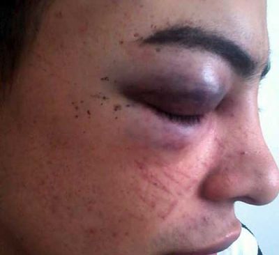 Se�alan a polic�a como autor de paliza a un joven