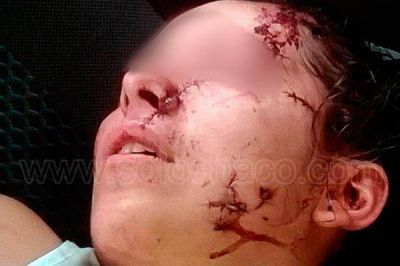 Atacan salvajemente a una adolescente en un boliche bailable de Resistencia