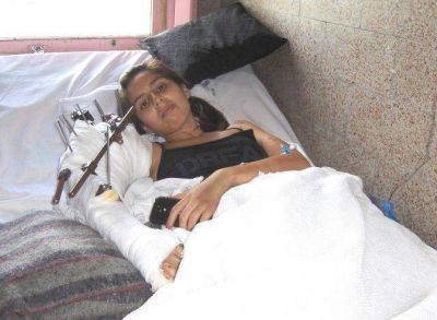 Le reimplantaron el brazo a una joven de Santa Teresita en el Hospital Interzonal