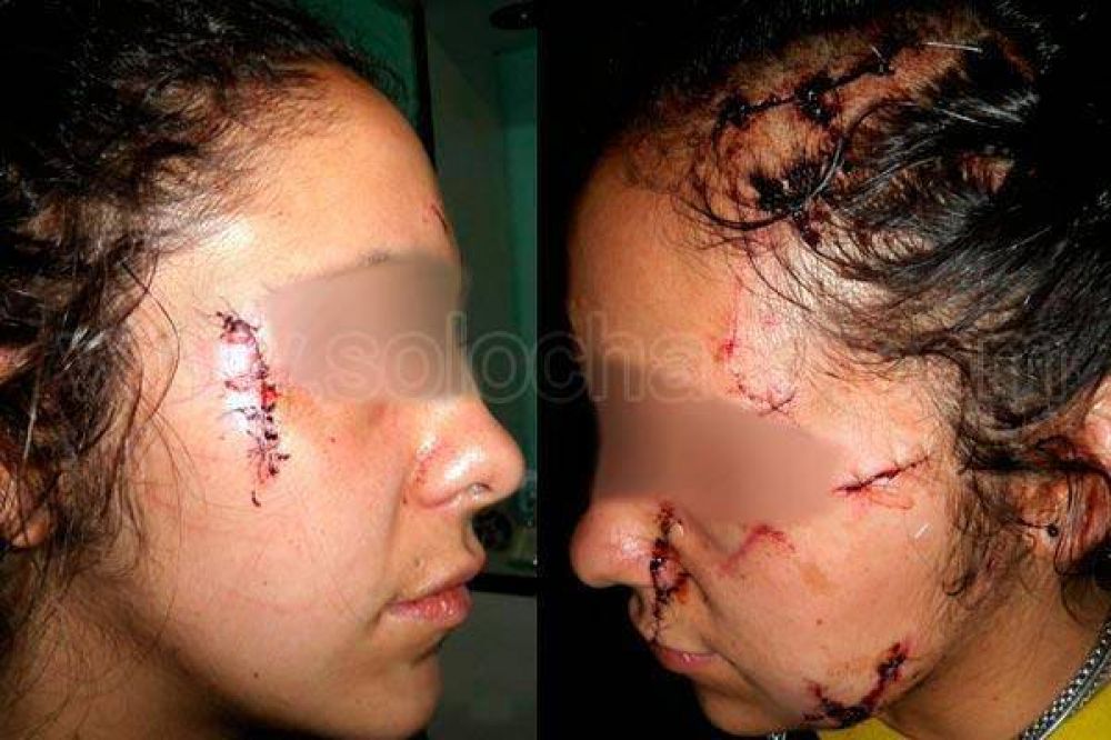Conmoci�n e indignaci�n por la salvaje agresi�n a Roc�o