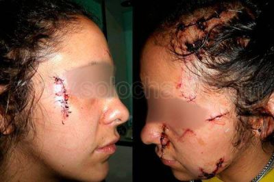 Conmoci�n e indignaci�n por la salvaje agresi�n a Roc�o