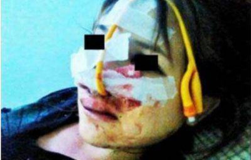 Perdi� dos litros de sangre la chica embarazada que fue desfigurada por su novio
