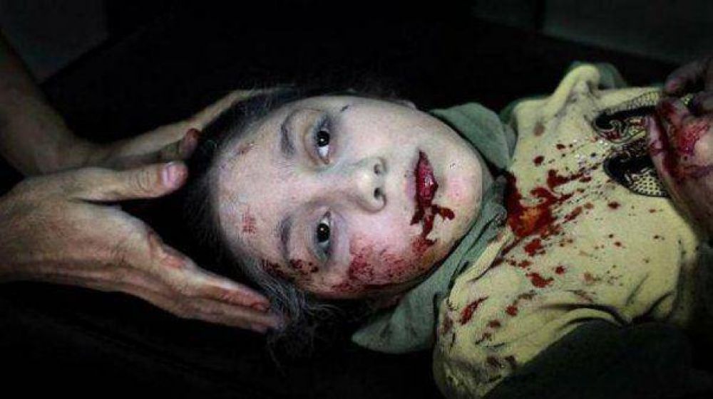 La foto del a�o 2013 seg�n Unicef: la mirada perdida de una ni�a herida por una bomba