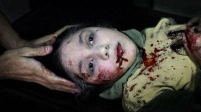 La foto del a�o 2013 seg�n Unicef: la mirada perdida de una ni�a herida por una bomba
