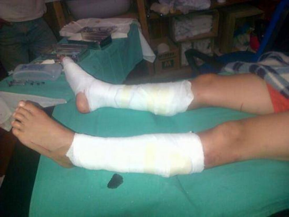 Lancha pas� por encima de dos ni�os en Villa Traful