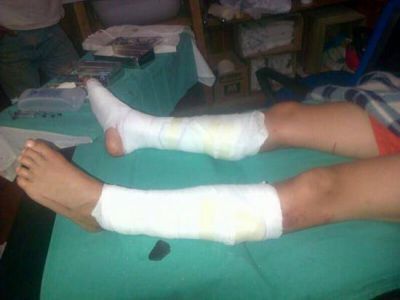 Lancha pas� por encima de dos ni�os en Villa Traful