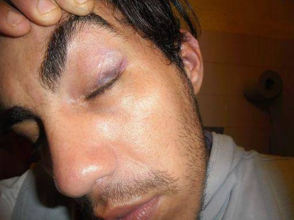 En Eldorado un joven denunci� una �feroz golpiza� de la polic�a 