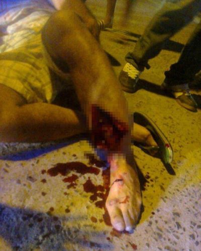 Ciclista perdi� la vida tras el choque con un motociclista
