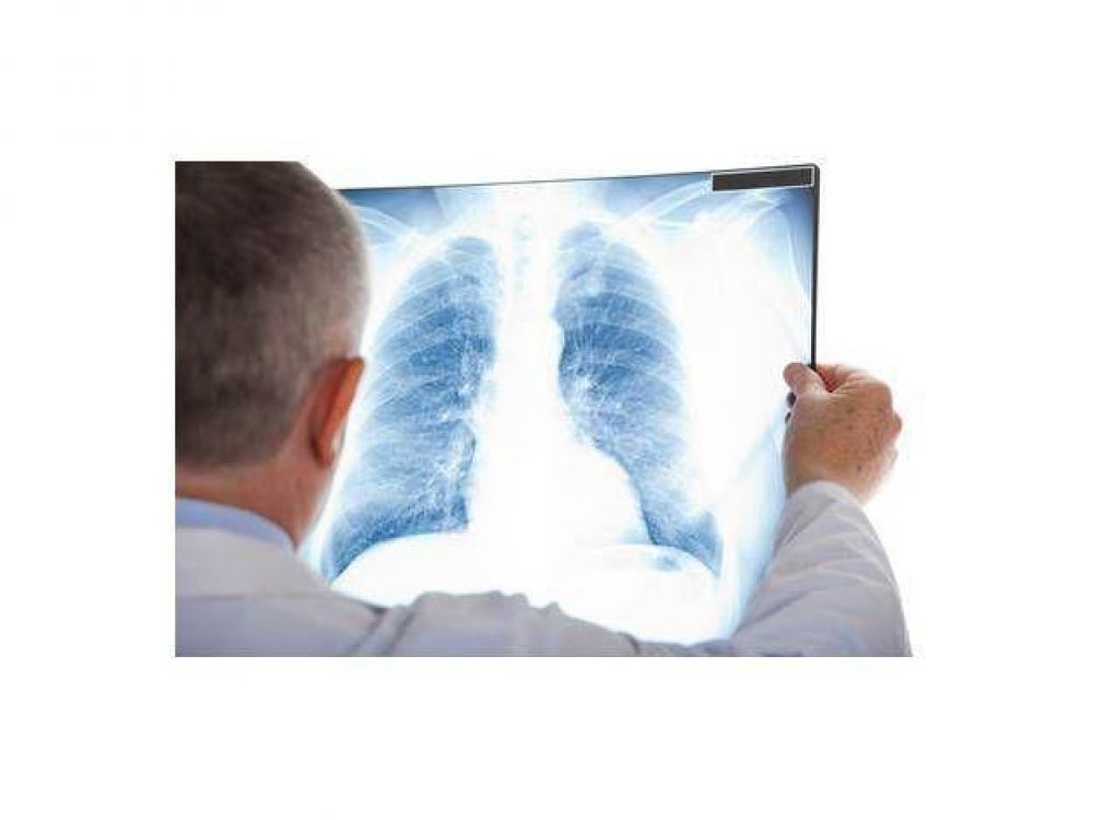 El diagnstico y el tratamiento correctos garantizan la curacin de la tuberculosis