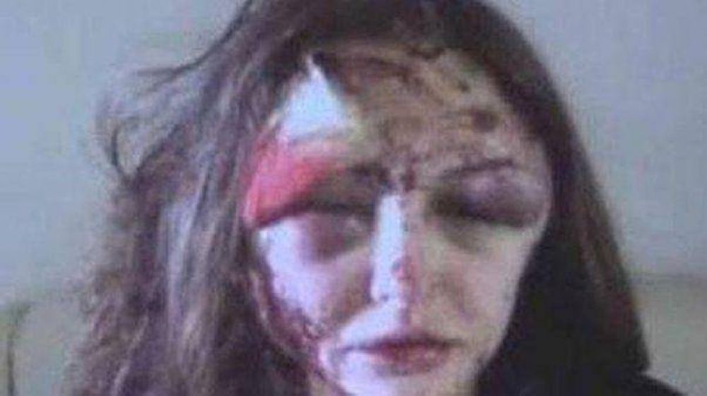 Un millonario ruso desfigur� a su novia por querer terminar la relaci�n que ten�a con �l