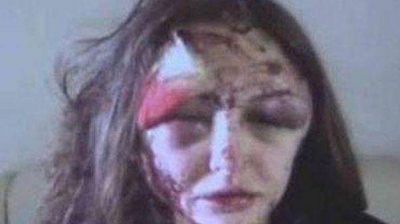 Un millonario ruso desfigur� a su novia por querer terminar la relaci�n que ten�a con �l