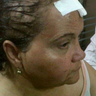 La anciana ferozmente golpeada relat� la noche del asalto