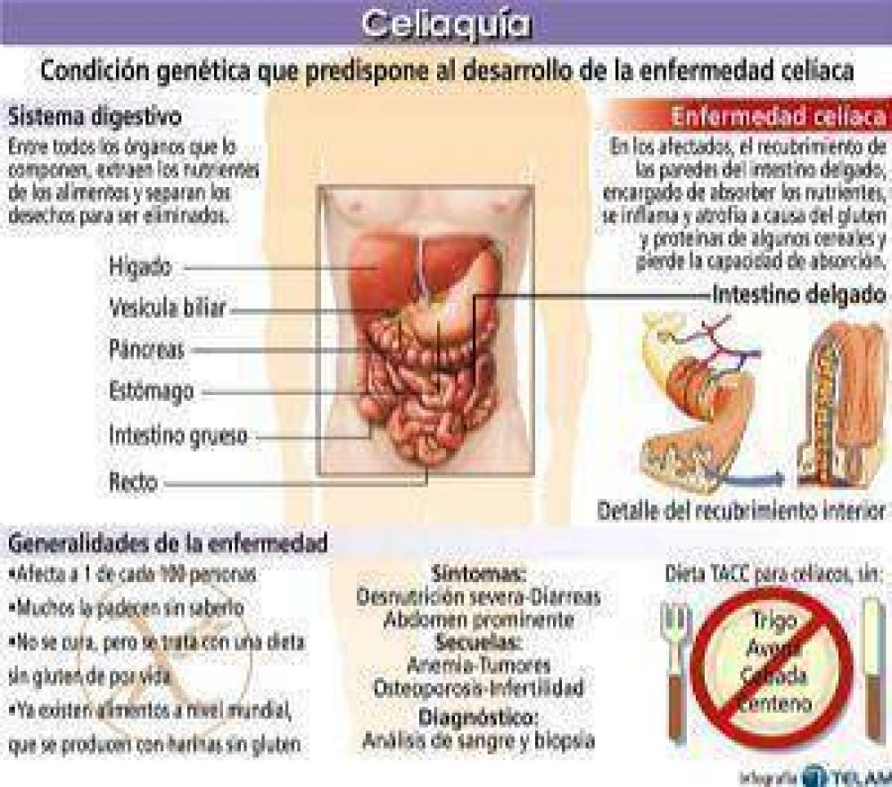 Cel�acos: realizar una dieta sin gluten en la Regi�n es m�s caro y dificultoso