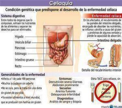 Cel�acos: realizar una dieta sin gluten en la Regi�n es m�s caro y dificultoso