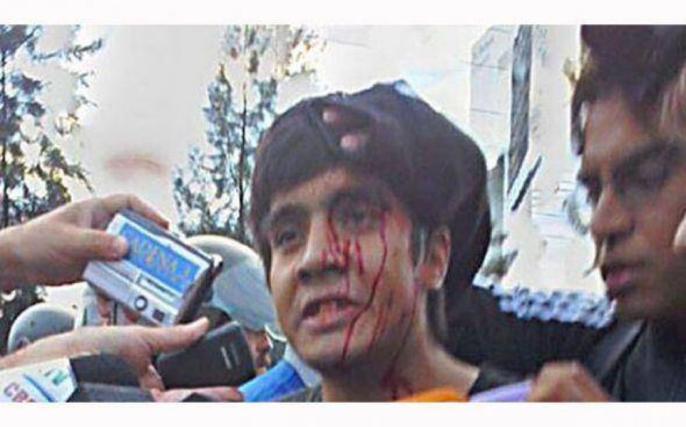 Ex trabajador de Kromberg herido tras enfrentarse con Gendarmer�a