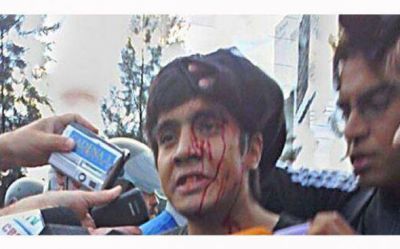 Ex trabajador de Kromberg herido tras enfrentarse con Gendarmer�a