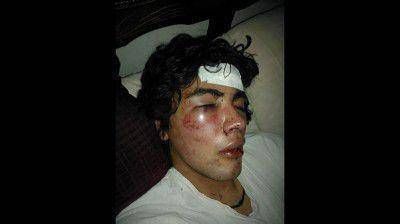 San Pedro: Brutal golpiza a un joven en el centro de la ciudad